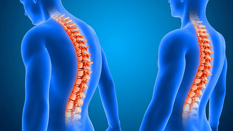 Degenerative Disc Disease: Causes, Symptoms and Treatment Methods